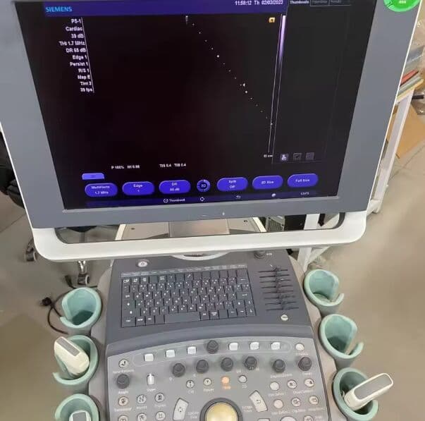Siemens Acuson X300 PE Color Doppler Ultrasound System