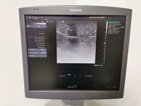 Siemens Acuson S2000 General Ultrasound System with 9L4 & 4C1 Transducers thumbnail 5