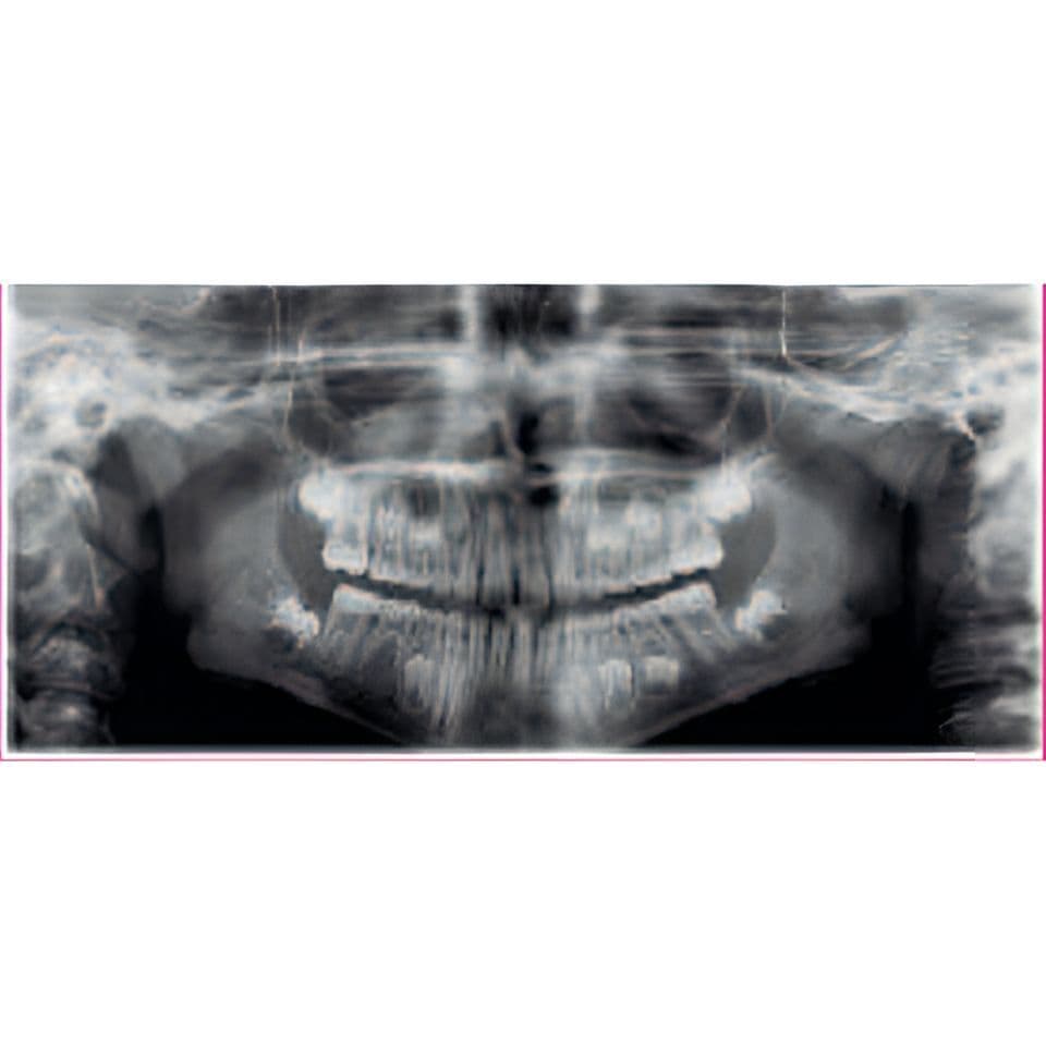 Planmeca ProMax Pan Dental X-Ray System thumbnail 3