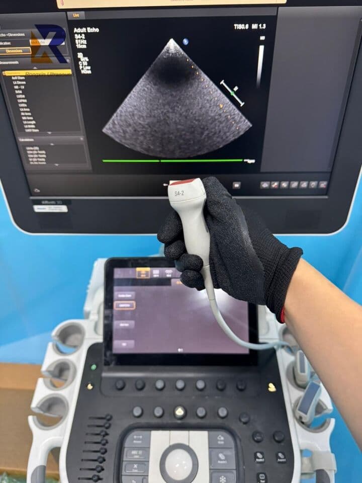 Philips Affiniti 30 Ultrasound System for OB/GYN Applications thumbnail 3