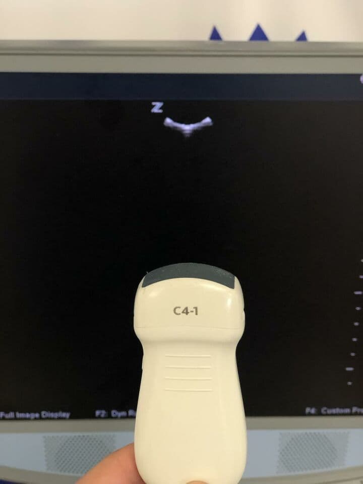 ZONARE Z-ONE Ultrasound System with Linear and Curved Array Probes thumbnail 4