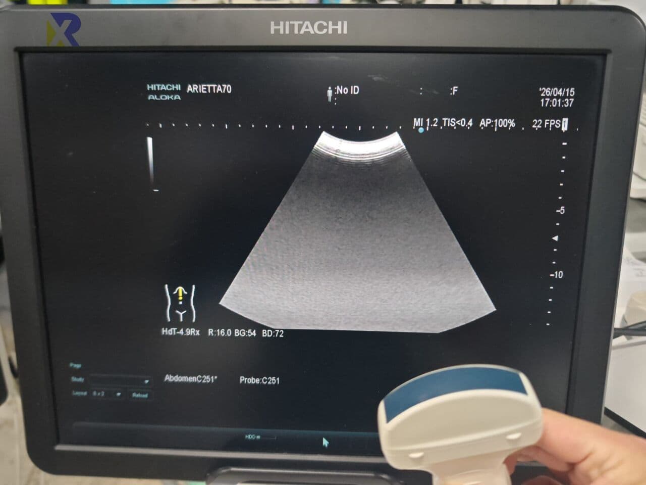 Hitachi Arietta 70 Diagnostic Ultrasound System thumbnail 2