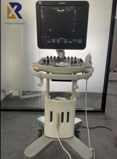 Philips ClearVue 580 Color Doppler Ultrasound System image 1
