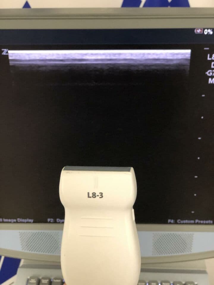 ZONARE Z-ONE Ultrasound System with Linear and Curved Array Probes thumbnail 5