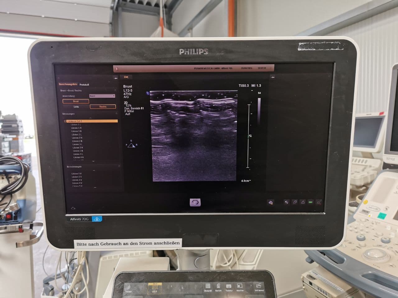 Philips L12-3 Linear Array Ultrasound Transducer thumbnail 6