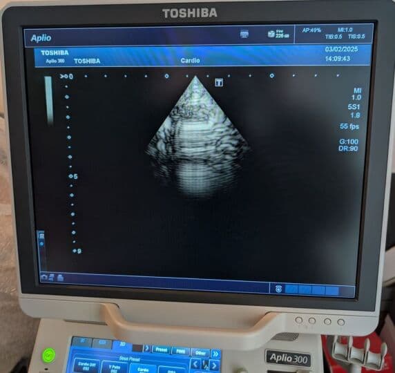 Toshiba PST-25BT Cardiac Ultrasound Transducer thumbnail 7