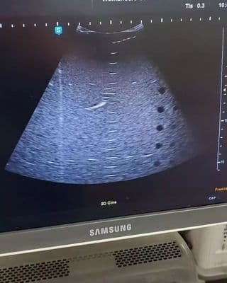 Samsung Medison CF2-8 Convex Array Ultrasound Probe image 1