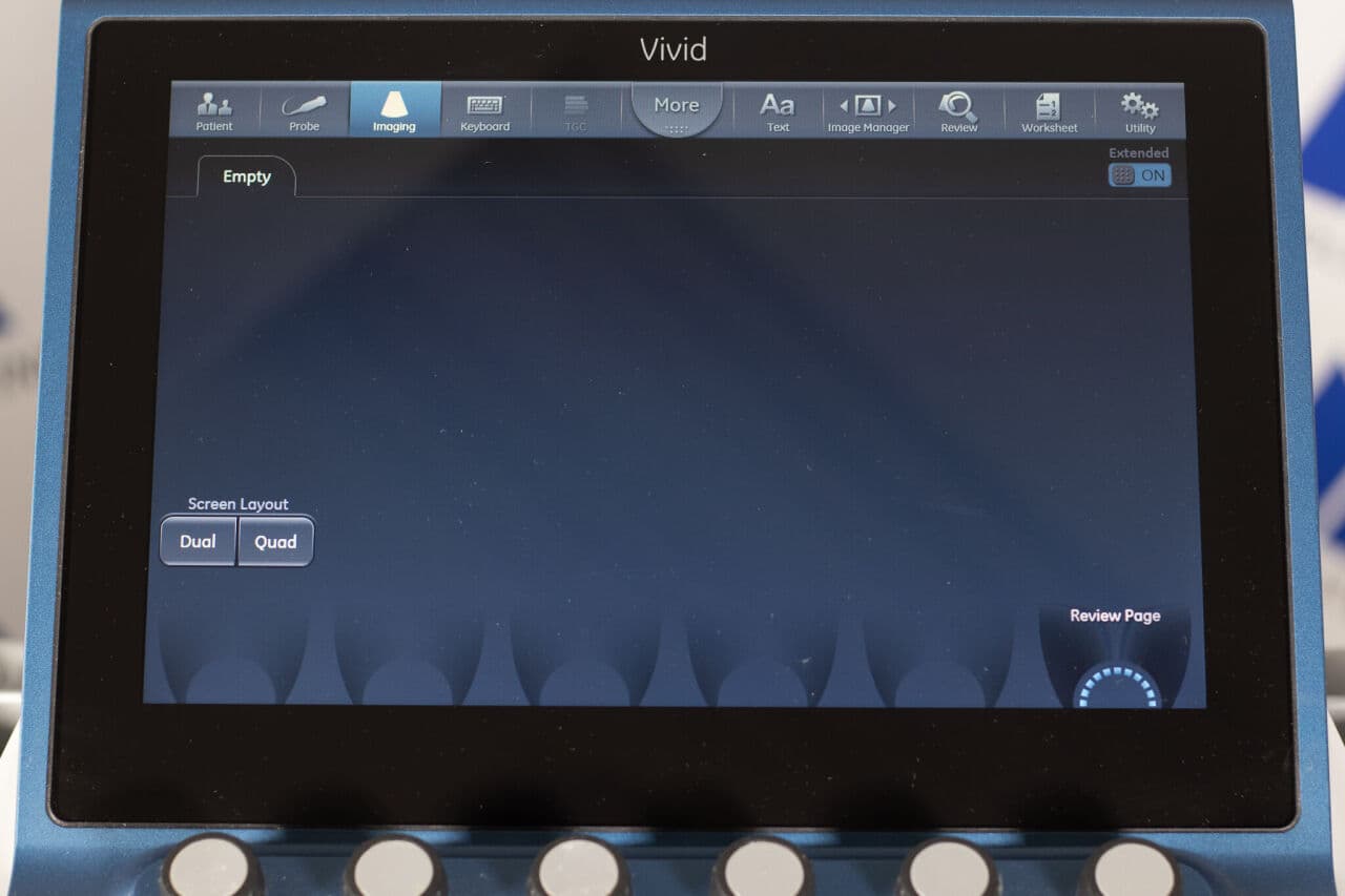 GE Vivid S70 4D Cardiovascular Ultrasound System thumbnail 2