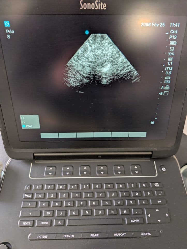 Sonosite rP19x Cardiac Ultrasound Transducer Probe thumbnail 6