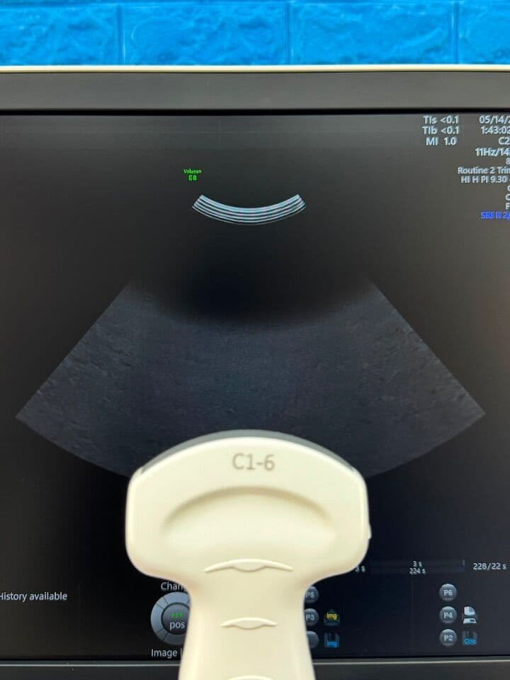 For Sale GE Voluson E8 YOM: 2019 Ultrasound Machine thumbnail 9