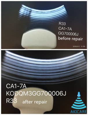 AKICARE CA1-7A Ultrasound Transducer for Samsung Medison