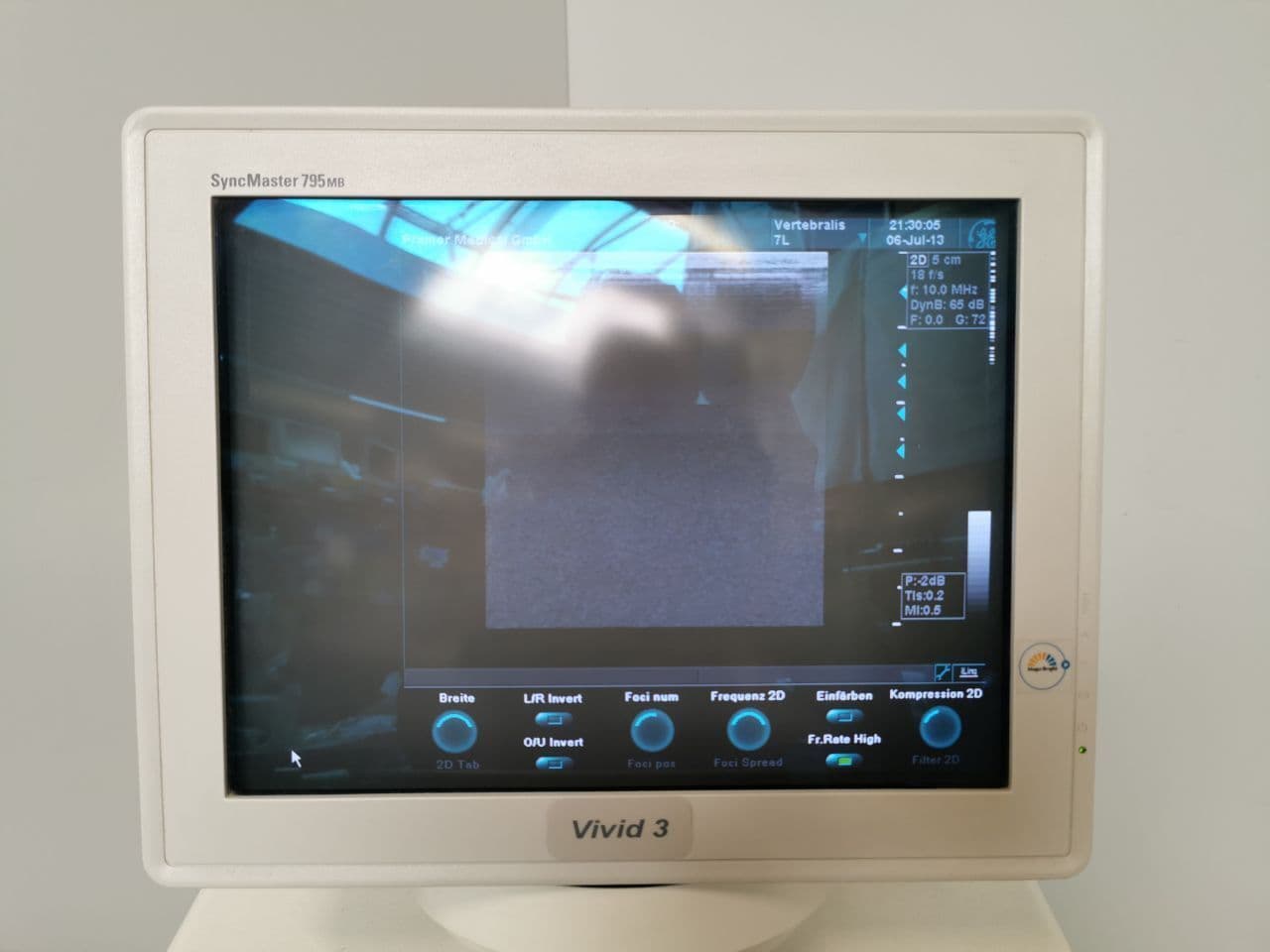 GE Healthcare 7L Linear Ultrasound Probe thumbnail 8