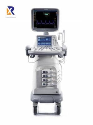 SonoScape S15 Trolley Color Doppler Ultrasound System image 1