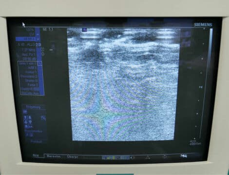 Siemens VFX 9-4 Linear Array Ultrasound Transducer thumbnail 3