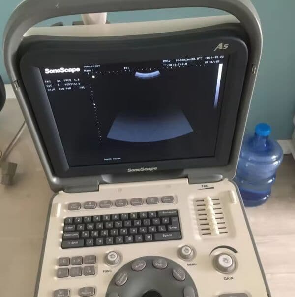 SonoScape A5 Portable B/W Ultrasound Scanner image 1