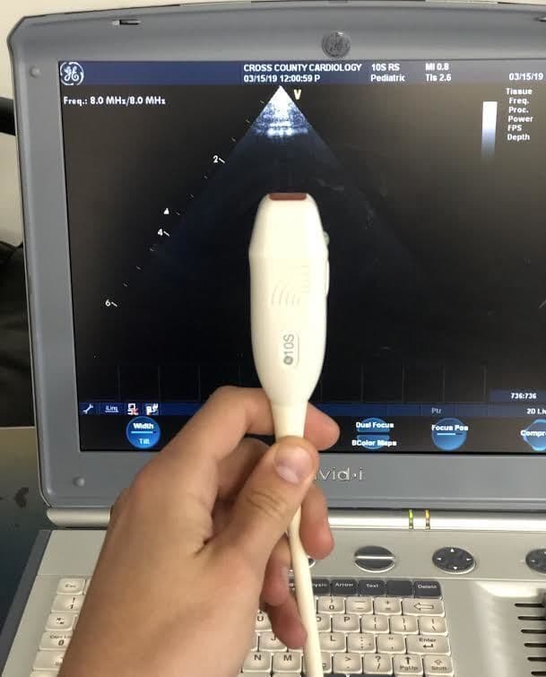 GE 10S-RS Sector Array Ultrasound Transducer image 1
