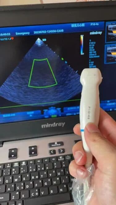 Mindray P10-4s Phased Array Ultrasound Transducer thumbnail 3