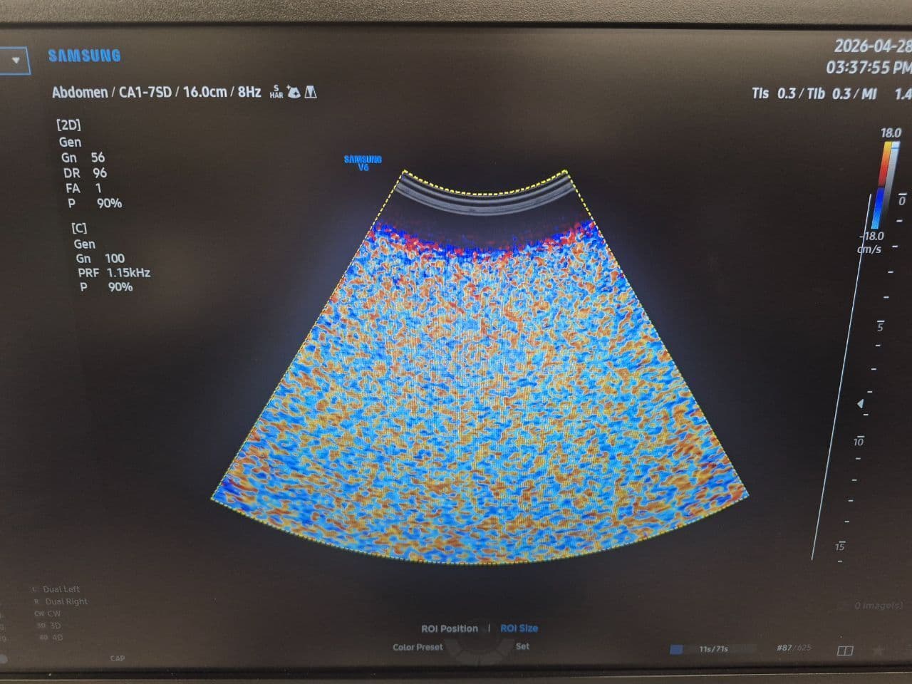 Samsung CA1-7SD Convex Array Ultrasound Transducer thumbnail 7