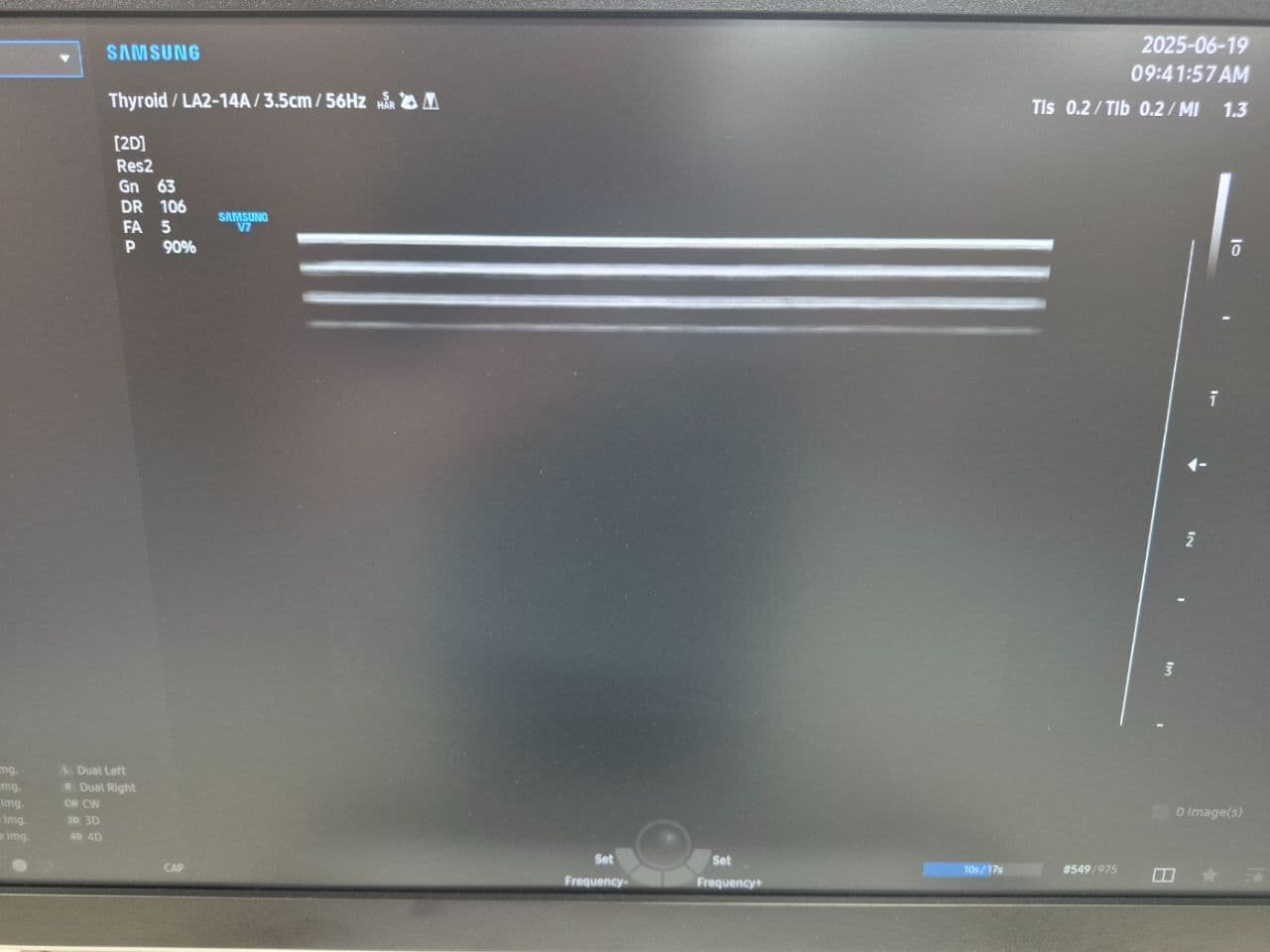 Samsung LA2-14A Linear Array Ultrasound Transducer thumbnail 6