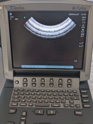 SonoSite C11x Micro-Convex Ultrasound Transducer thumbnail 8