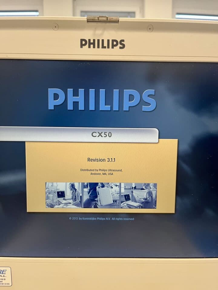 Philips CX50 Cardiac Ultrasound System Console thumbnail 2