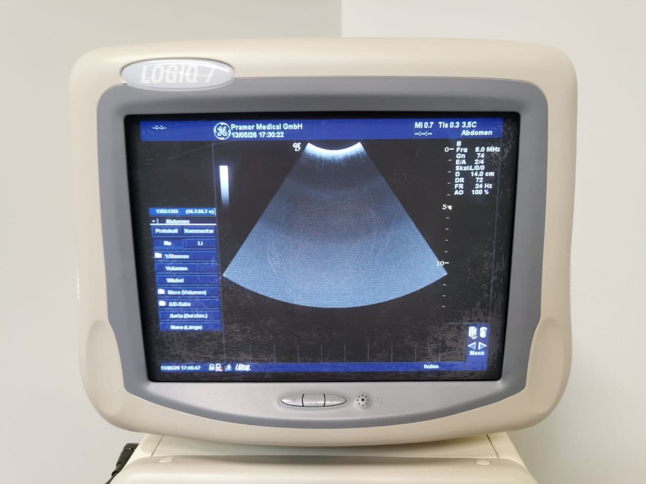 GE Yokogawa LOGIQ 7 — Diagnostic Ultrasound System thumbnail 8