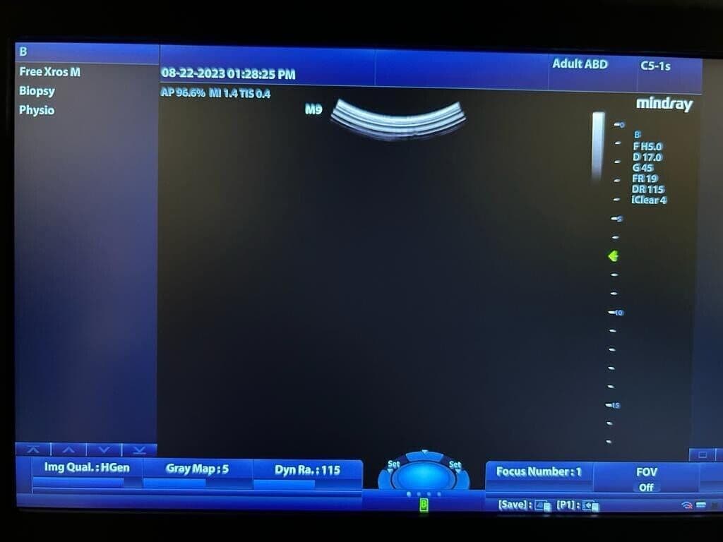 Mindray C5-1 Curved Array Ultrasound Transducer thumbnail 6