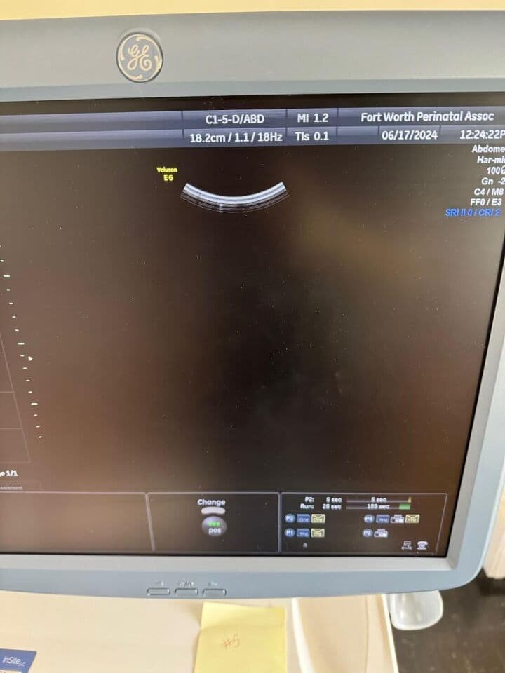 GE Voluson E6 3D/4D Ultrasound System thumbnail 9