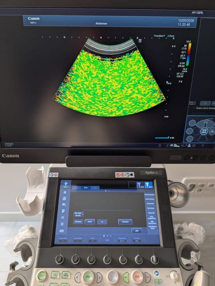 Toshiba Aplio A Diagnostic Ultrasound System thumbnail 10