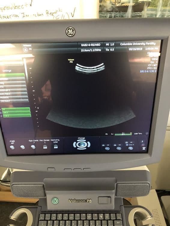 GE RAB2-6-RS 3D/4D Curved Array Ultrasound Transducer thumbnail 4