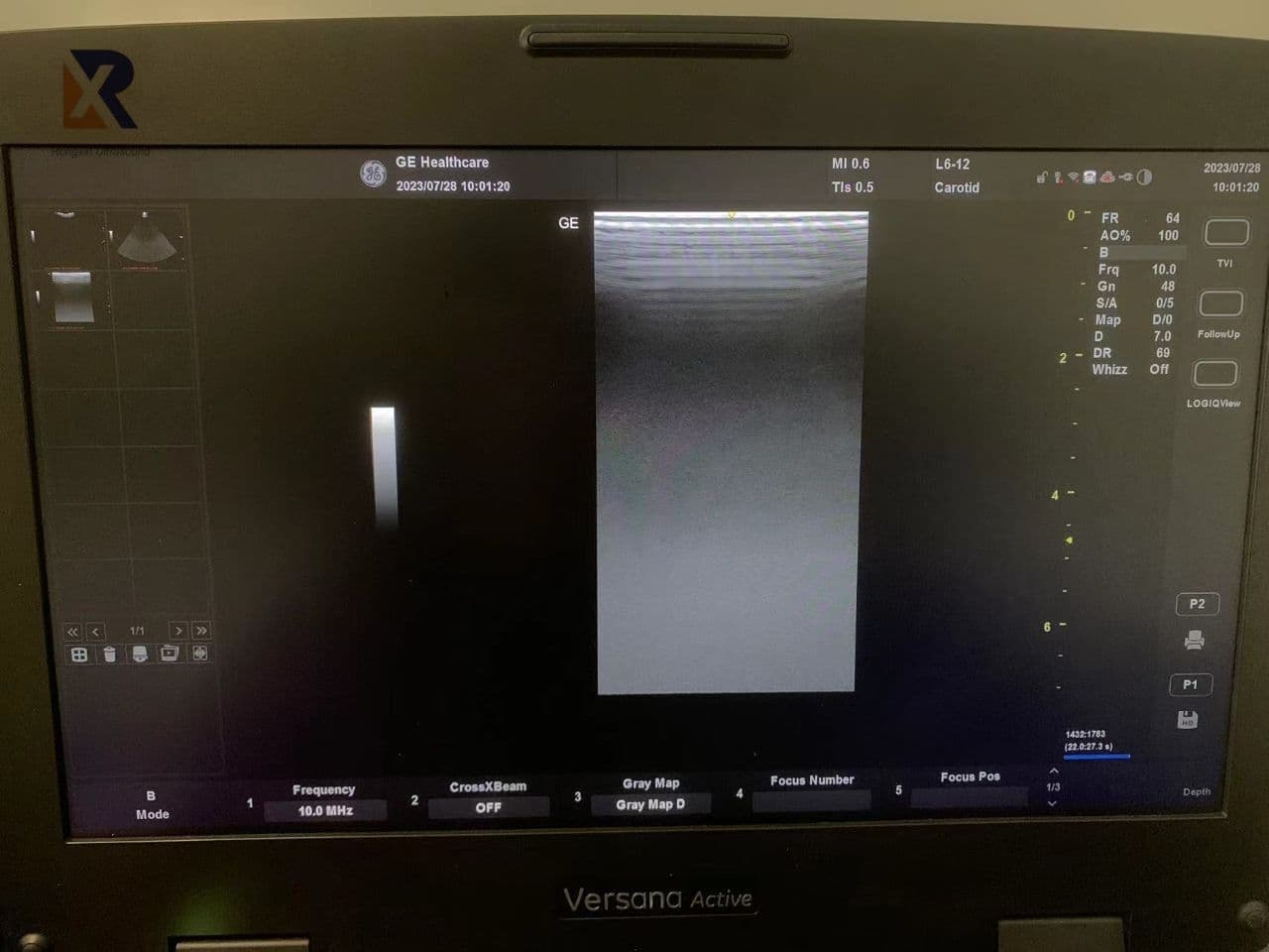 GE L6-12-RS Linear Ultrasound Probe thumbnail 4