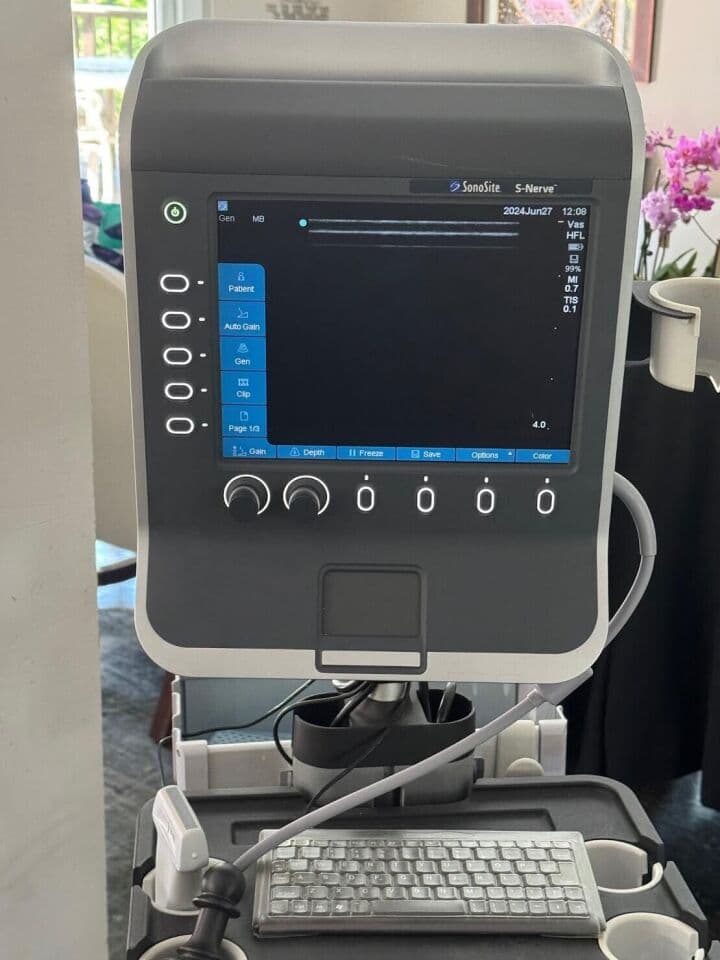 Sonosite S-Nerve Ultrasound System with Cart and L38x Vascular Probe thumbnail 4