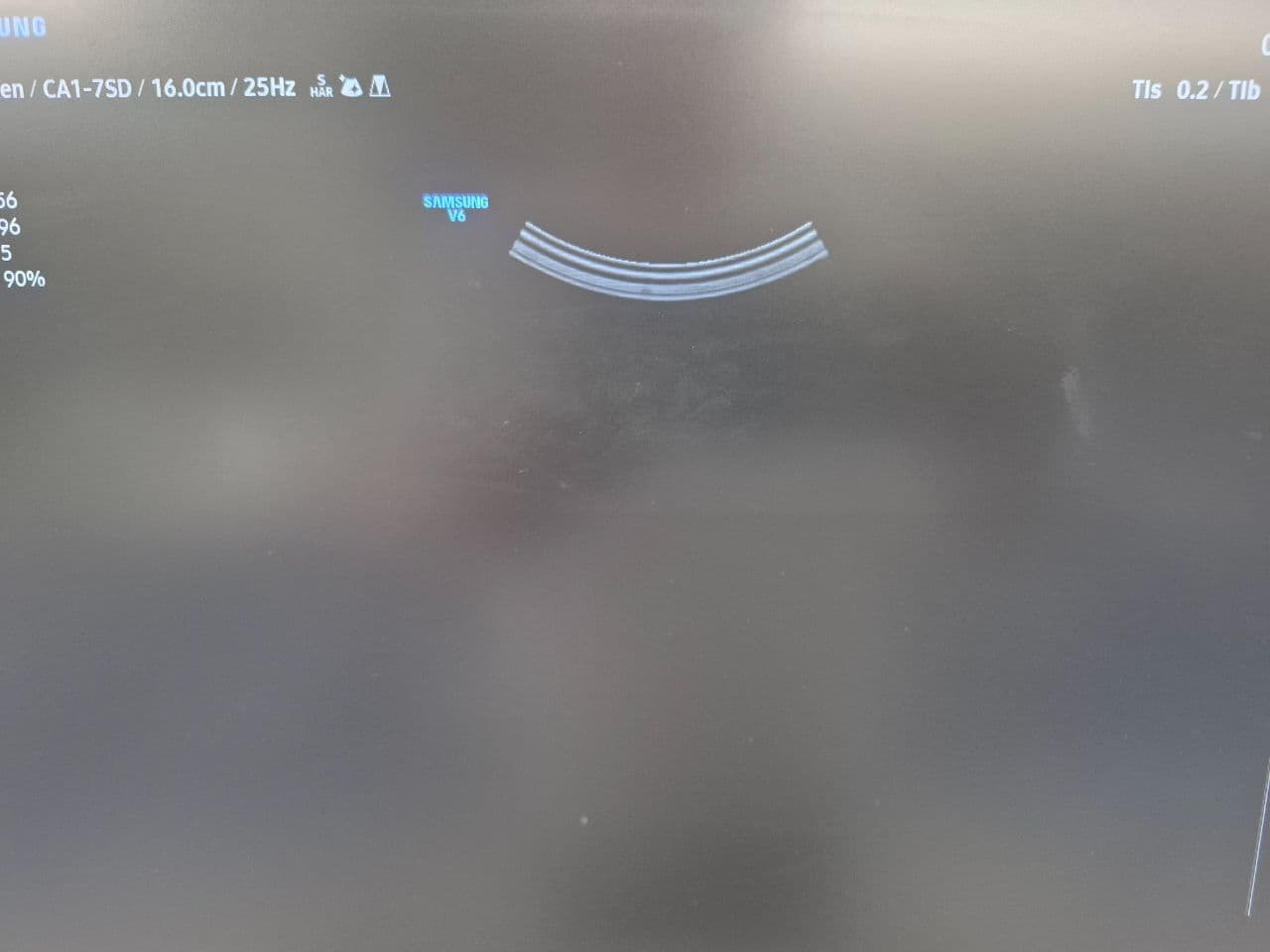 Samsung CA1-7SD Convex Array Ultrasound Transducer thumbnail 6