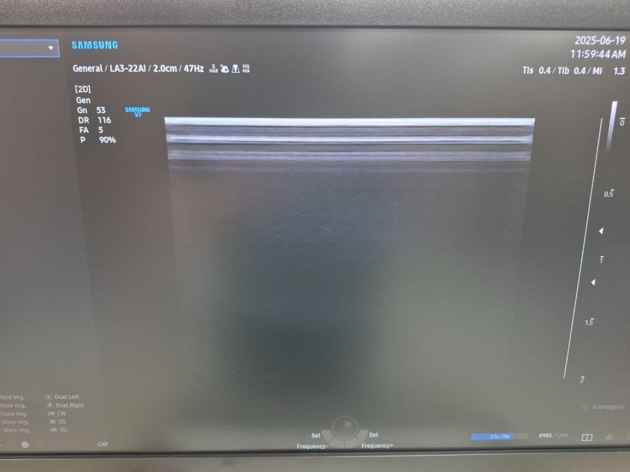 Small Parts and Superficial Imaging Ultrasound Transducer — Samsung L3-22AI thumbnail 5