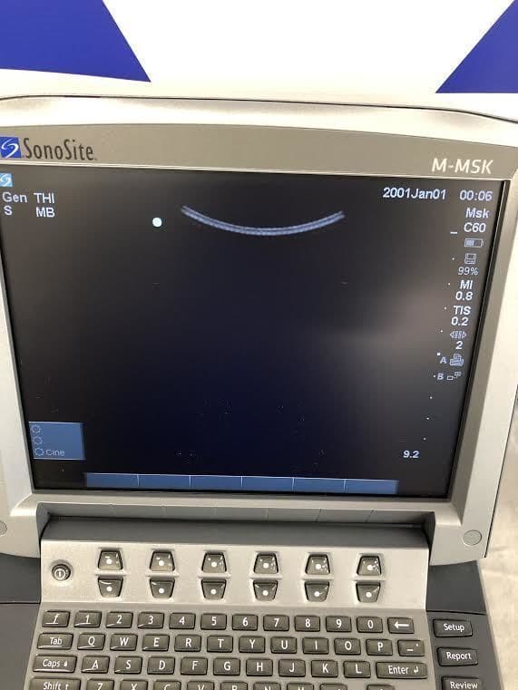 Sonosite C60x Curved Array Ultrasound Transducer thumbnail 3