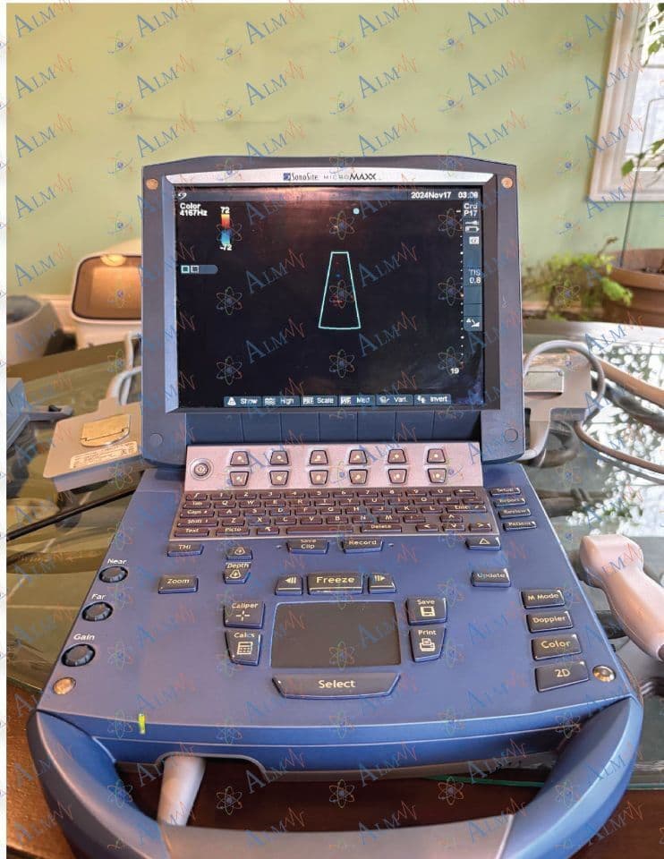 Portable Ultrasound System — Sonosite MicroMaxx with Cardiac & Vascular Probes thumbnail 4