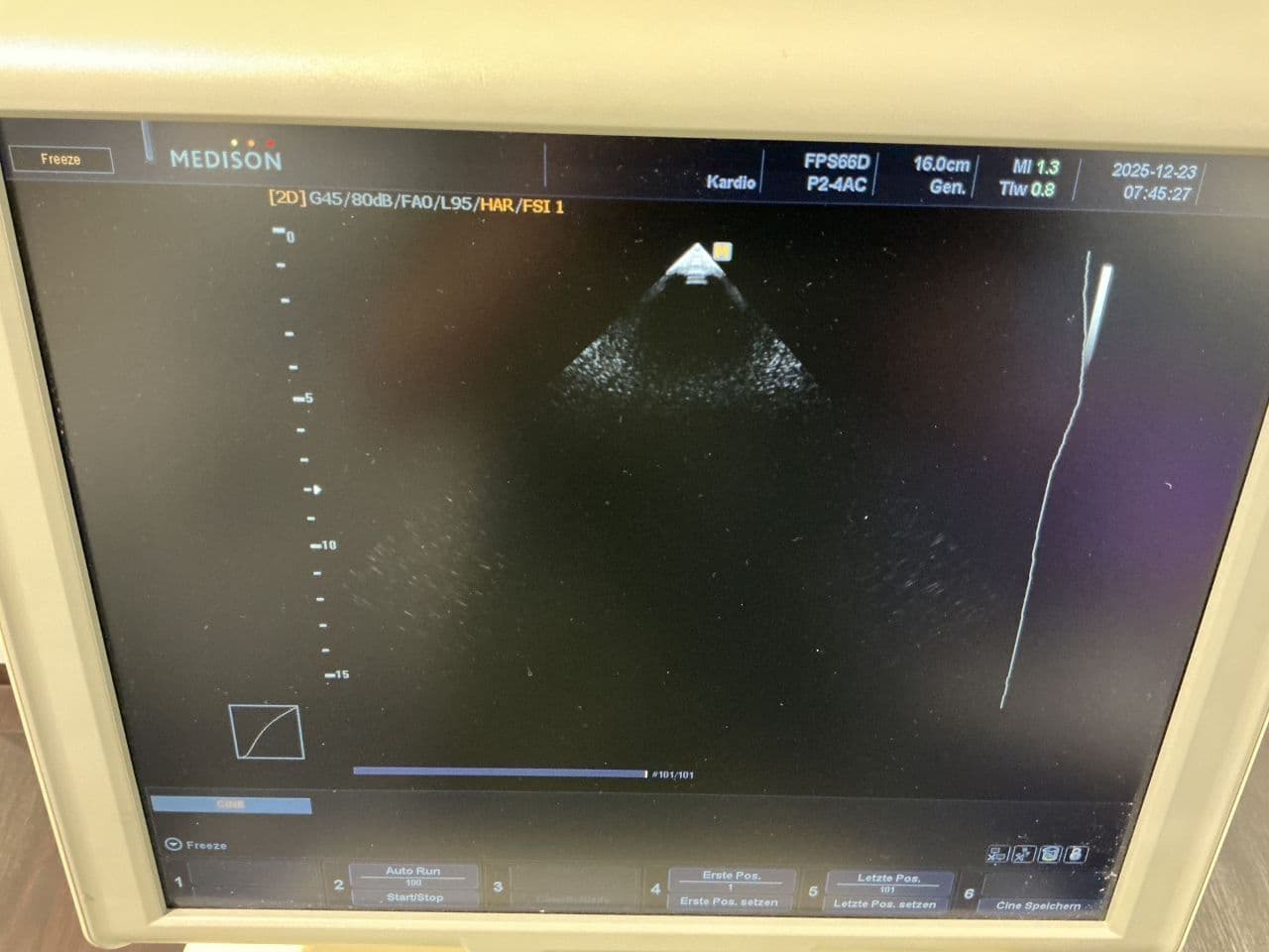 For Sale SAMSUNG Accuvix V10 Cardiac - Vascular Ultrasound thumbnail 4