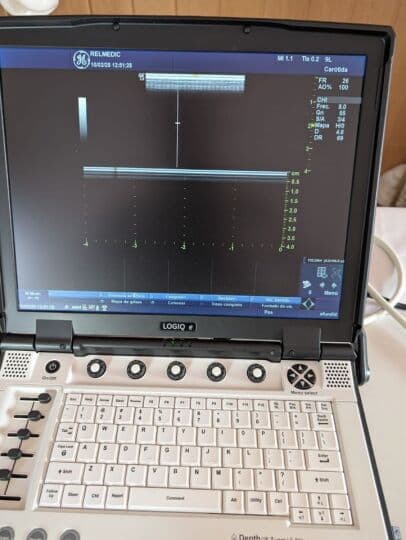GE 9L-RS Linear Array Ultrasound Transducer thumbnail 6