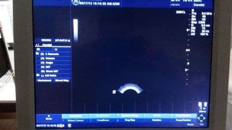 GE BE9C Bi-Plane Endocavity Ultrasound Transducer thumbnail 3