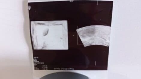 GE EM6C 4D Convex Matrix Ultrasound Transducer thumbnail 5