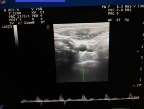 Kontron LA523K Linear Ultrasound Transducer for Esaote Technos thumbnail 8
