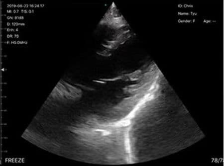 Mindray P4-2s Phased Array Ultrasound Transducer for M5/M7/TE7 Systems thumbnail 2
