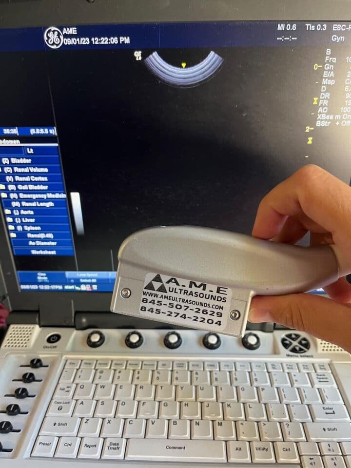 GE E8C-RS Endocavitary Ultrasound Transducer thumbnail 3