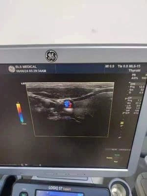 GE ML6-15 Linear Array Ultrasound Transducer thumbnail 2