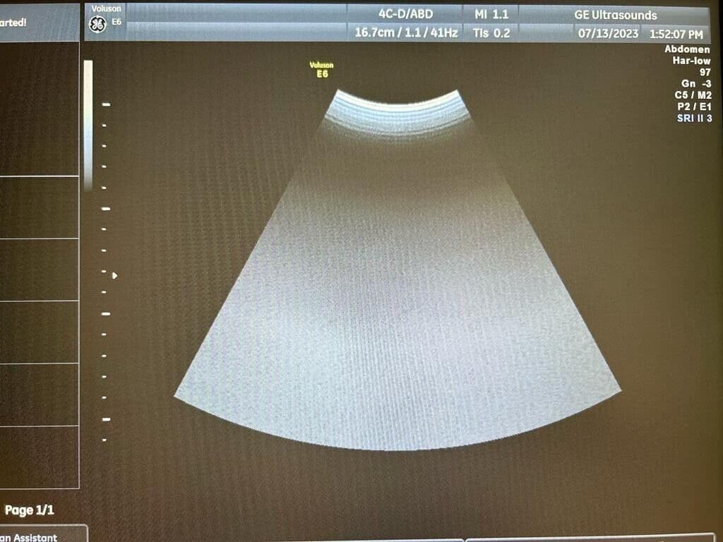 GE 4C-D Convex Ultrasound Transducer for Abdominal & OB/GYN Imaging image 1
