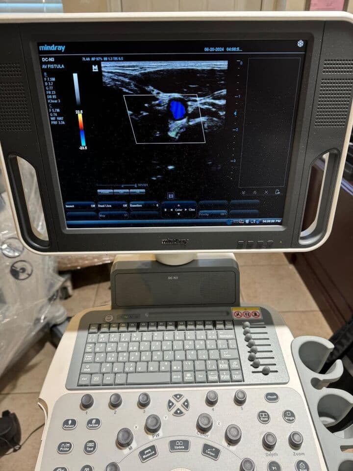 Mindray DC-N3 OB/GYN & Vascular Diagnostic Ultrasound System thumbnail 7