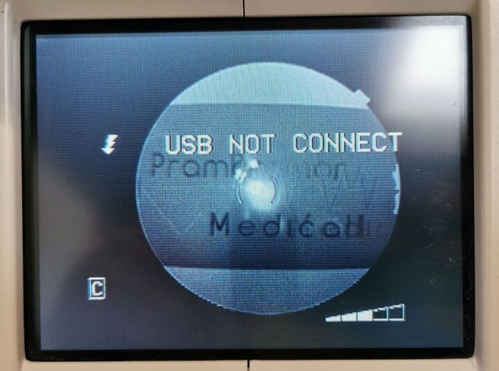 Retinal Imaging Fundus Camera — Topcon TRC-NW100 thumbnail 8