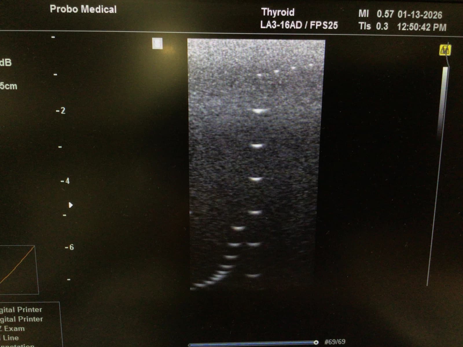 Samsung LA3-16AD Linear Ultrasound Probe for HS40, HM70 EVO and V4 Systems – Vascular, Small Parts and MSK Imaging
