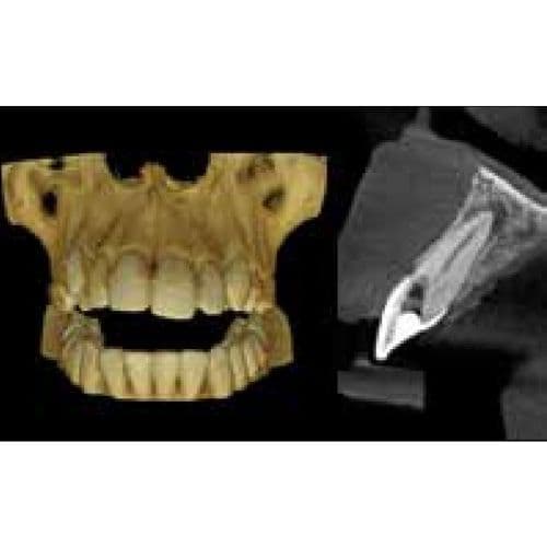 Carestream CS8100 3D Panoramic and CBCT Dental X-Ray System (2020) thumbnail 4