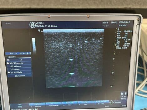 GE i739-RS Intraoperative Linear Ultrasound Transducer thumbnail 4